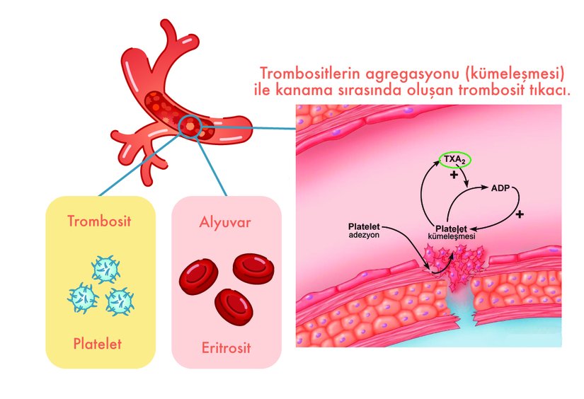 Agregasyonun şematik gösterimi.