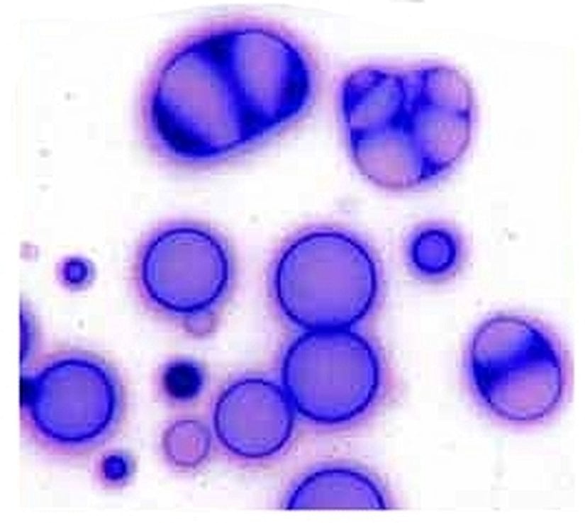 Koaservat benzeri yapılanmalar...