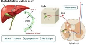 Discovering How Targeting ACER3 Aids Cholestatic Liver Injury