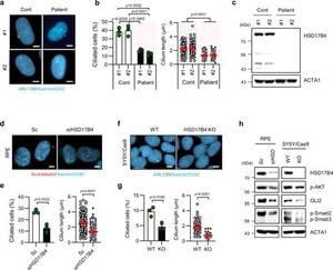 New Research Links HSD17B4 Deficiency To Ciliopathy Symptoms