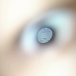 Telefon kamerasının mikroskoba dönmesinin nedeni nedir?