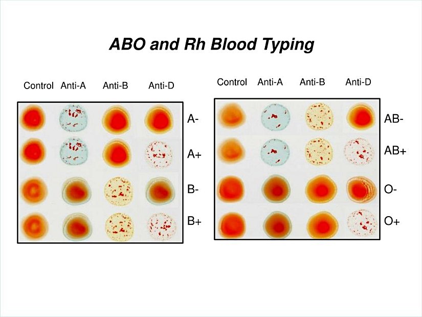 Kan grubu ve Rh faktörü belirlenmesi