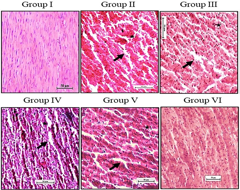 Kardiyak fibrozis  Histoloji Mikroskop Görüntüsü