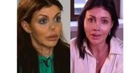 Алиса Казьмина полностью восстановила нос, который был обезображен из-за болезни