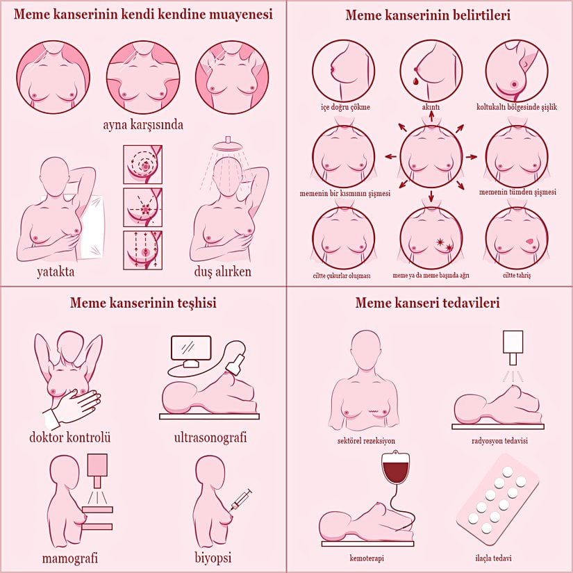 Meme kanserinde kendi kendine muayenenin basamakları.