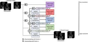 New AI Network Improves MRI Image Analysis For Lung Perfusion