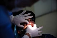 Anvisa interdita pasta de dentes Colgate Clean Mint após casos de alergia