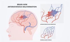 Study Reveals Region-Specific Responses Of CNS Macrophages