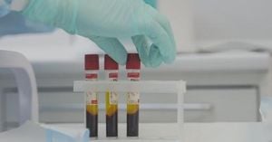 Galleri Blood Test Shows Promise In Early Cancer Detection