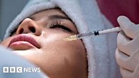 Move over fillers - people are getting facial injections derived from fish sperm