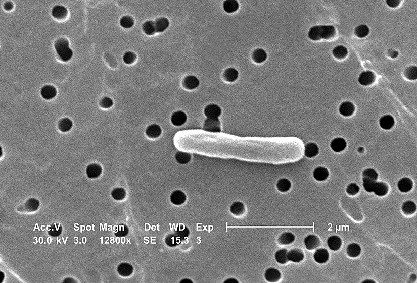 Elektron mikroskobu altında bir Escherichia coli bakterisi.