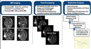 New MRI Radiomics Model Predicts Endometrial Cancer Biomarkers