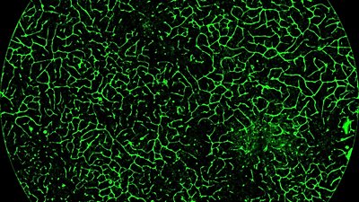 Genetik Mühendisliği ile Kök Hücrelerden Mini Karaciğerler Üretmek ve Bunları Kullanarak, Karaciğer Hastalığı Olan Farelerin Ömrünü Uzatmak Mümkün!