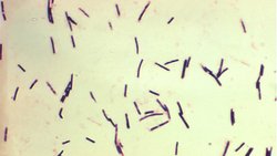 Neden az pişmiş tavuk yok?