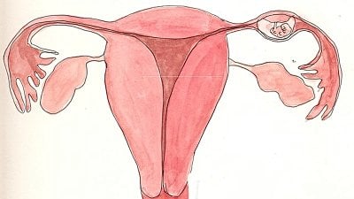 Ektopik Gebelik Nedir? Nasıl Tespit Edilir, Nasıl Tedavi Edilir?