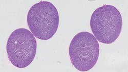 Yapay Zeka ile Hastalık Tespitinde Yeni Bir Devrim.