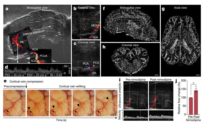 Araştırmada incelenen dokulara bir örnek