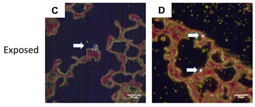 2 haftalık erkek (C) ve dişi (D) fare yavrularının akciğerlerinde tespit edilen mikro nanoplastikler