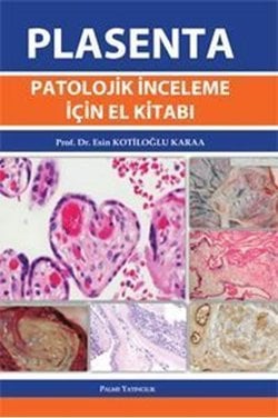 Plasenta Patolojik İnceleme İçin El Kitabı