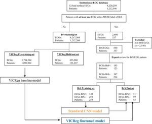 New Deep Learning Model Better Detects Brugada Syndrome ECGs