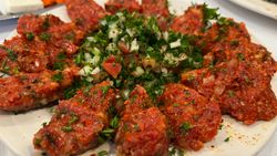 Etli Çiğ Köfte Neden Yasaklandı? Trichinella Spiralis Ve Trişinozis Üzerine