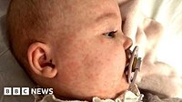 County Durham mother's vaccination plea after 'terrifying' measles