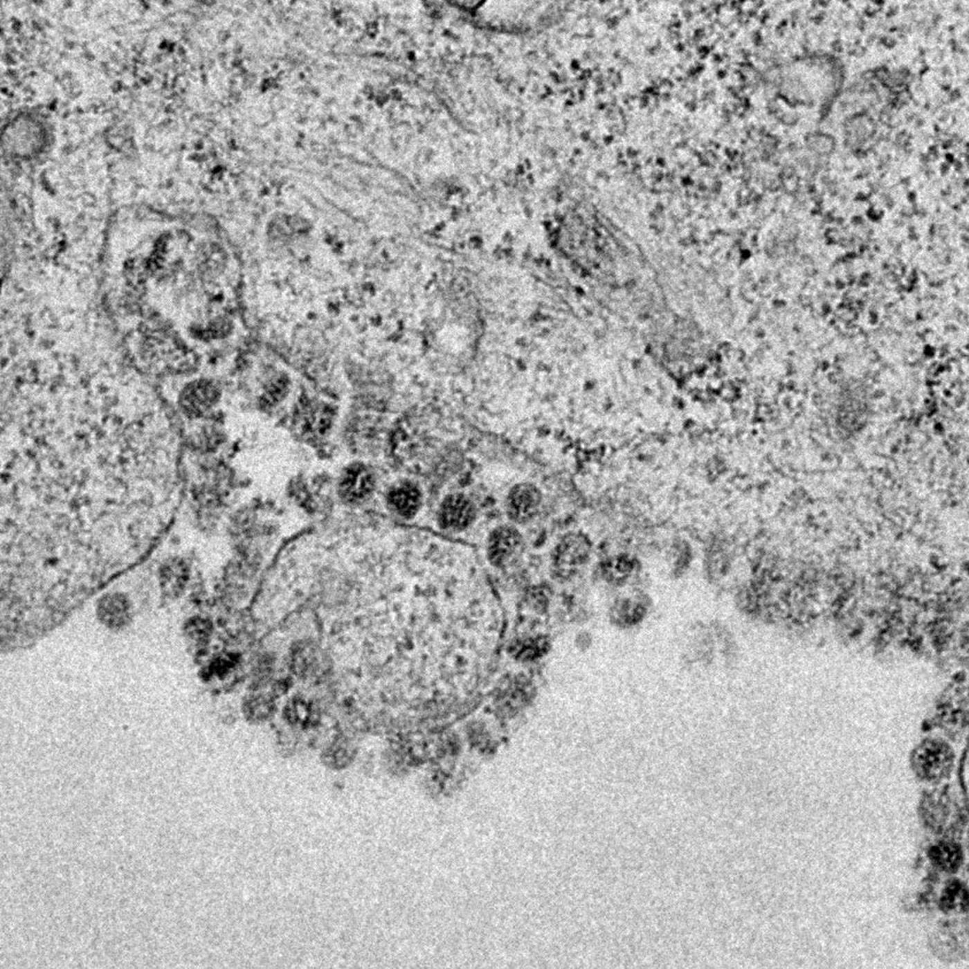 Koronavirüs Hastalığı (COVID-19) ile İlgili Gerçekler ve Genel Tavsiyeler