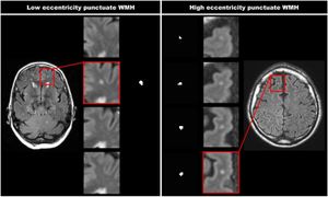 New Four-Pool Model Enhances Understanding Of Proton Relaxation