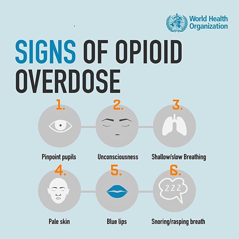 Opioid Aşırı Doz Belirtileri  (Soldan sağa) Toplu iğne başı gözbebekleri, Bilinç kaybı, Sığ/Yavaş nefes alma, Soluk ten rengi, Morarmış dudaklar, Horlama/Hırıltılı nefes
