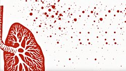 Verem Nedir? Tüberkülozun Belirtileri ve Tedavi Seçenekleri Nelerdir?