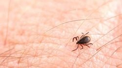 Lyme Hastalığı