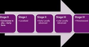 Machine Learning Model Enhances DCIS Prediction Accuracy