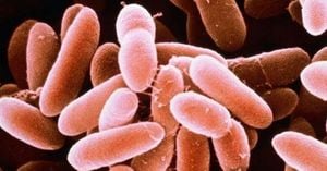 Tragic Listeria Outbreak Linked To Hospital Desserts Claims Three Lives