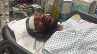 Michail Antonio releases first photo from after his horror car crash