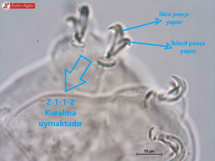 Ekstremite anatomisi.