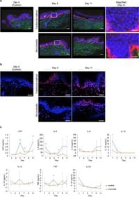 Development of a novel technology for long-term culture and live imaging of excised human tissue - Scientific Reports