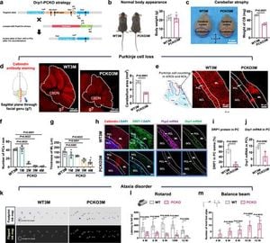 Mitochondrial Transplantation Offers Hope For Cerebellar Degeneration