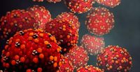 New measles case identified in WA as list of exposure sites grows
