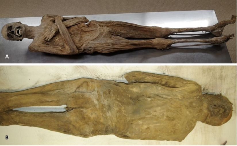 Mumyanın ventral(A) ve dorsal(B) taraftan görünüşü tamamen korunmuş bir vücut duvarını gösteriyor. Görsel: Andreas Nerlich.