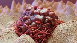 Kronik Stres, Kanserin “Görünmez” Biyolojik Tetikleyicisi Olabilir mi?