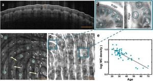 Skin Health Linked To Touch Sensitivity And Friction