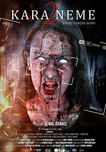 Kara Neme 2