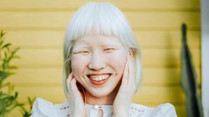 Discovering Life With Albinism: Ririko's Story