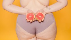 Erkeklerde Neden Selülit Oluşmaz?