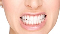 Uyku sırasında çene kilitlenmesi sorunu (ve yanı sıra kabuslar) için diş hekimine mi danışmalıyım yoksa psikolog veya psikiyatra mı?