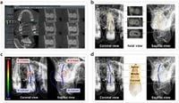 Three-dimensional analysis of root canal curvature in maxillary premolars using CBCT images - Scientific Reports