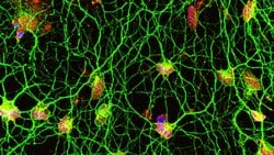 Kaybedilen Anıların ve Unutulan Hafızanın Bazı İzleri Hücre Çekirdeğinde Saklanıyor Olabilir!