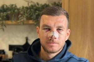 Edin Dzeko Suffers Facial Injury But Bosnia Secures Win