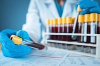 Oxford BioDynamics unveils new target use for EpiSwitch blood test