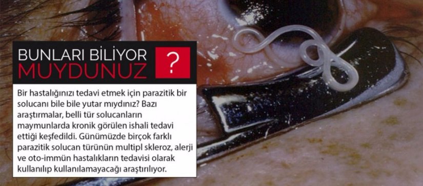 Parazitik Solucanlarla Bazı Hastalıkları Tedavi Etmek Mümkün Olabilir!